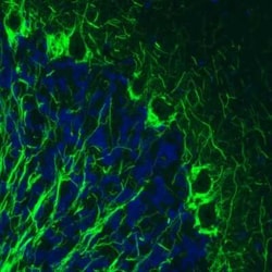 NF-M Antibody (CL2705), Novus Biologicals:Antibodies:Primary Antibodies
