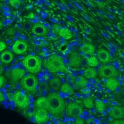 NF-M Antibody (CL2705), Novus Biologicals:Antibodies:Primary Antibodies