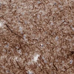 NF-M Antibody (CL2705), Novus Biologicals:Antibodies:Primary Antibodies
