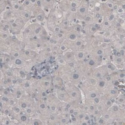 NF-M Antibody (CL2705), Novus Biologicals:Antibodies:Primary Antibodies