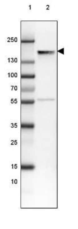 NF-M Antibody (CL2705), Novus Biologicals:Antibodies:Primary Antibodies