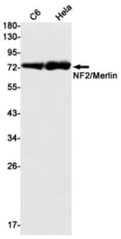 NF2/Merlin Antibody (S07-1A6), Novus Biologicals 50 &mu;g; Unconjugated:Antibodies,