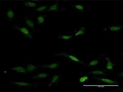 NFAT5 Antibody, Novus Biologicals 0.05 mg | Buy Online | Novus Biologicals | Fisher Scientific