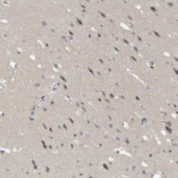 NFATC2/NFAT1 Antibody, Novus Biologicals 0.1 mL; Unconjugated:Antibodies,