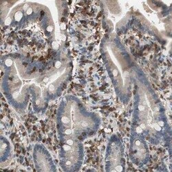 NFATC2/NFAT1 Antibody, Novus Biologicals 25 &mu;L; Unconjugated:Anticorps,