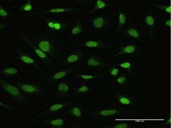 NFATC2IP Antibody, Novus Biologicals 0.1 mg; Unconjugated:Antibodies, Polyclonal