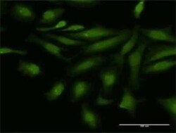 NFATC4 Antibody, Novus Biologicals 0.1 mg | Buy Online | Novus Biologicals | Fisher Scientific