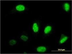 NFIB Antibody (2D6), Novus Biologicals 0.1 mg | Buy Online | Novus Biologicals | Fisher Scientific