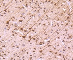 NFIB Antibody, Novus Biologicals 100 &mu;L | Buy Online | Novus Biologicals | Fisher Scientific