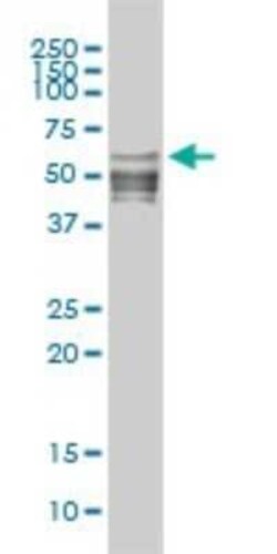 NFIC Antibody (1C12-2A2), Novus Biologicals 0.1 mg | Buy Online | Novus Biologicals | Fisher Scientific