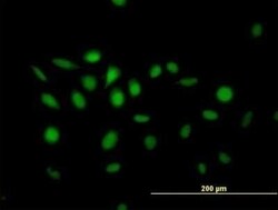 NFIX Antibody, Novus Biologicals 0.05 mg | Buy Online | Novus Biologicals | Fisher Scientific