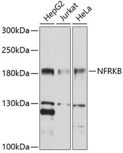 NFRKB Antibody - BSA Free, Novus Biologicals 0.02 mL, Unconjugated:Antibodies,