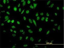 NFX1 Antibody (1D12), Novus Biologicals 0.1 mg | Buy Online | Novus Biologicals | Fisher Scientific