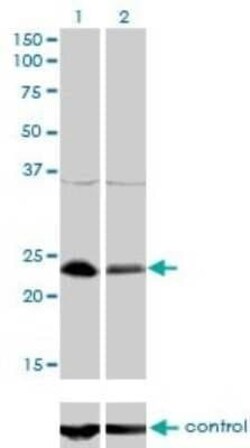 NFYB Antibody (6H6), Novus Biologicals 0.1 mg | Buy Online | Novus Biologicals | Fisher Scientific