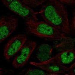 NFYB Rabbit anti-Human, Polyclonal, Novus Biologicals:Antibodies:Primary