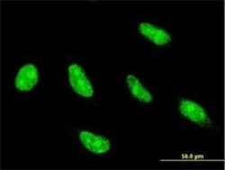 NFYC Antibody (1D3), Novus Biologicals 50 &mu;g | Buy Online | Novus Biologicals | Fisher Scientific