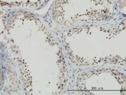 NFYC Antibody (1D3), Novus Biologicals 50 &mu;g | Buy Online | Novus Biologicals | Fisher Scientific