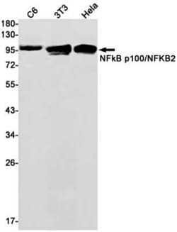 NFkB p100/p52 Rabbit anti-Human, Mouse, Rat, Clone: S04-4D6, Novus Biologicals