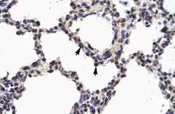 NFkB p100/p52 Antibody, Novus Biologicals 100 &mu;L; Unconjugated:Antibodies,
