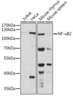 NFkB p100/p52 Antibody - Azide and BSA Free, Novus Biologicals:Antibodies:Primary
