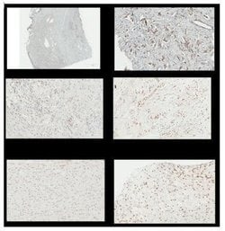 NFkB p105/p50 Antibody (2J10D7) - Azide and BSA Free, Novus Biologicals