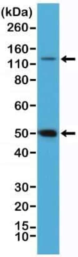 NFkB p105/p50 Antibody (RM299), Novus Biologicals 100 &mu;g | Buy Online | Novus Biologicals | Fisher Scientific
