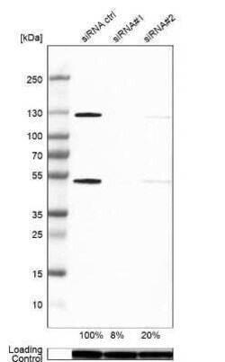 NFkB p105/p50 Antibody, Novus Biologicals 0.1 mL | Buy Online | Novus Biologicals | Fisher Scientific