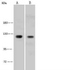 NFkB1/NFkB p105 Antibody, Novus Biologicals 100 &mu;g; Unconjugated:Anticorps,