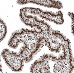 NFkB2/NFkB p100 Antibody (CL8266), Novus Biologicals 100 &mu;L; Unconjugated:Antibodies,