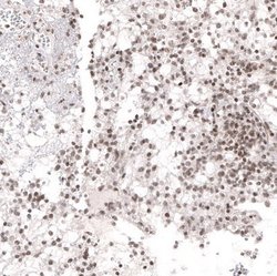 NFkB2/NFkB p100 Antibody (CL8266), Novus Biologicals 100 &mu;L; Unconjugated:Antibodies,