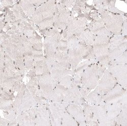NFkB2/NFkB p100 Antibody (CL8266), Novus Biologicals 100 &mu;L; Unconjugated:Antibodies,
