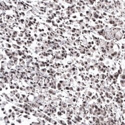 NFkB2/NFkB p100 Antibody (CL8266), Novus Biologicals 100 &mu;L; Unconjugated:Antibodies,