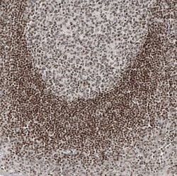 NFkB2/NFkB p100 Antibody (CL8266), Novus Biologicals 100 &mu;L; Unconjugated:Antibodies,