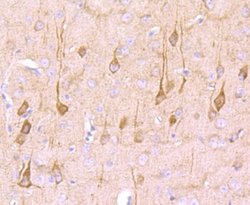 NG2/MCSP Antibody (JM10-13), Novus Biologicals 100&mu;L:Antibodies, Monoclonal