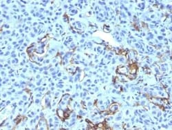 NGFR/TNFRSF16/p75NTR Antibody (NGFR5 + NTR/912), Novus Biologicals:Antibodies:Primary