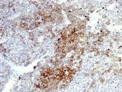 NGFR/TNFRSF16/p75NTR Antibody (NGFR5 + NTR/912), Novus Biologicals:Antibodies:Primary