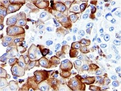 NGFR/TNFRSF16/p75NTR Antibody (NGFR5), Novus Biologicals:Antibodies:Primary