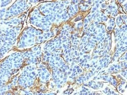 NGFR/TNFRSF16/p75NTR Antibody (NTR/912), Novus Biologicals 0.02mg; Unlabeled:Antibodies,