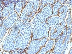 NGFR/TNFRSF16/p75NTR Antibody (SPM299), Novus Biologicals:Antibodies:Primary
