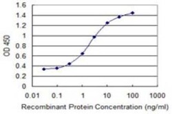 NGL-1/LRRC4C Antibody (1G5), Novus Biologicals 0.1 mg; Unconjugated:Antikörper