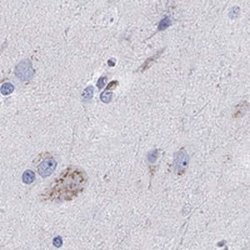 NGL-1/LRRC4C Rabbit anti-Human, Polyclonal, Novus Biologicals:Antibodies:Primary