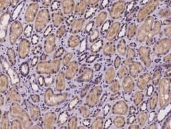 NGLY1 Antibody, Novus Biologicals 100 &mu;g, Unconjugated:Antibodies, Polyclonal