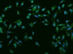 NGX6 Antibody, Novus Biologicals 100 &mu;g, Unconjugated:Antibodies, Polyclonal