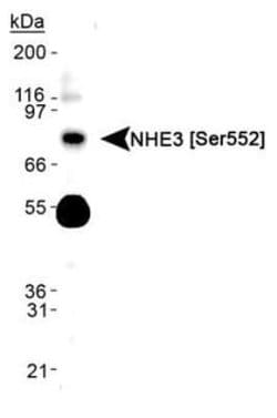 NHE3/SLC9A3, p Ser552 Antibody (14D5) - Azide and BSA Free, Novus Biologicals