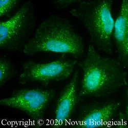 NHE3/SLC9A3 Antibody - BSA Free, Novus Biologicals 0.025 mg; Unconjugated:Antibodies,