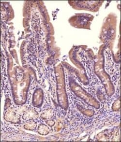 NHE3/SLC9A3 Antibody - BSA Free, Novus Biologicals 0.025 mg; Unconjugated:Antibodies,