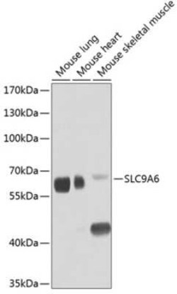 NHE6/SLC9A6 Antibody - BSA Free, Novus Biologicals 0.1 mL; Unconjugated:Antibodies,