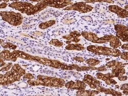 NHLH2 Antibody, Novus Biologicals 100 &mu;g, Unconjugated:Antibodies, Polyclonal