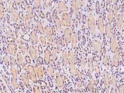 NICE-3 Antibody, Novus Biologicals:Antibodies:Primary Antibodies