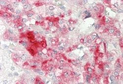 NINL Rabbit anti-Human, Polyclonal, Novus Biologicals 0.1 mL | Buy Online | Novus Biologicals | Fisher Scientific